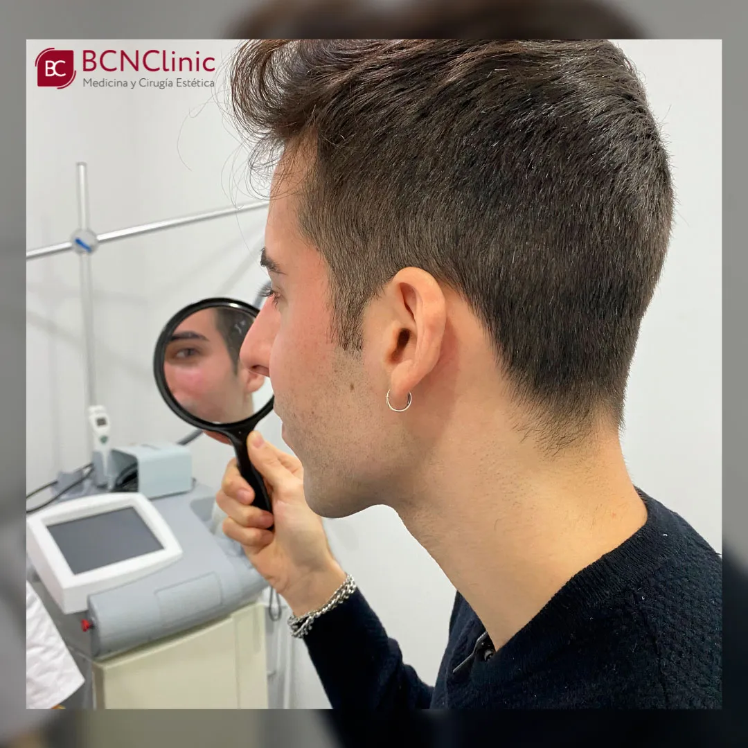 rellenos masculinos barcelona