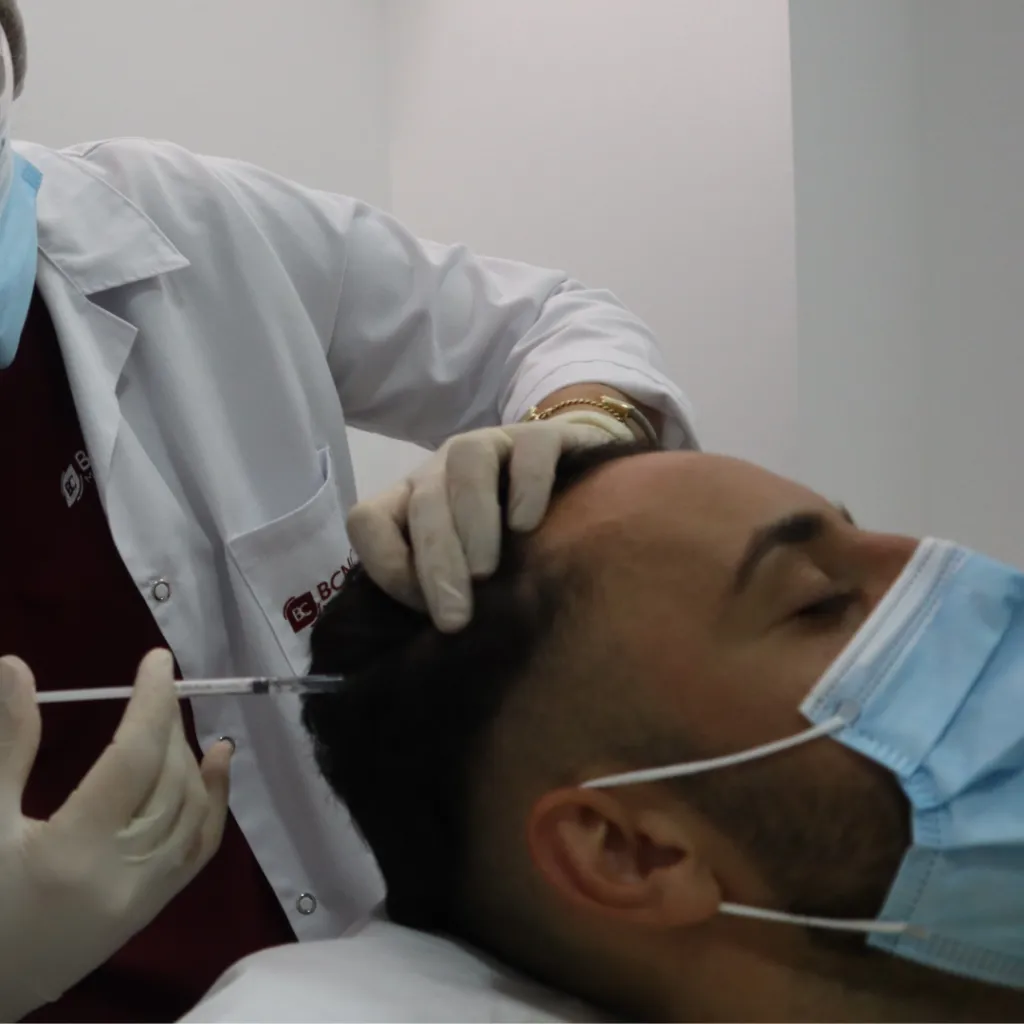 Mesoterapia capilar Barcelona