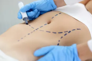 Claves sobre la Marcación Abdominal antes de hacértela