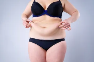 tratamiento BodyTite