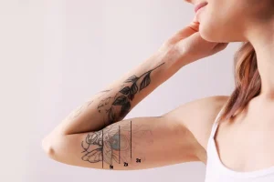 Proceso de eliminación de tatuajes con láser