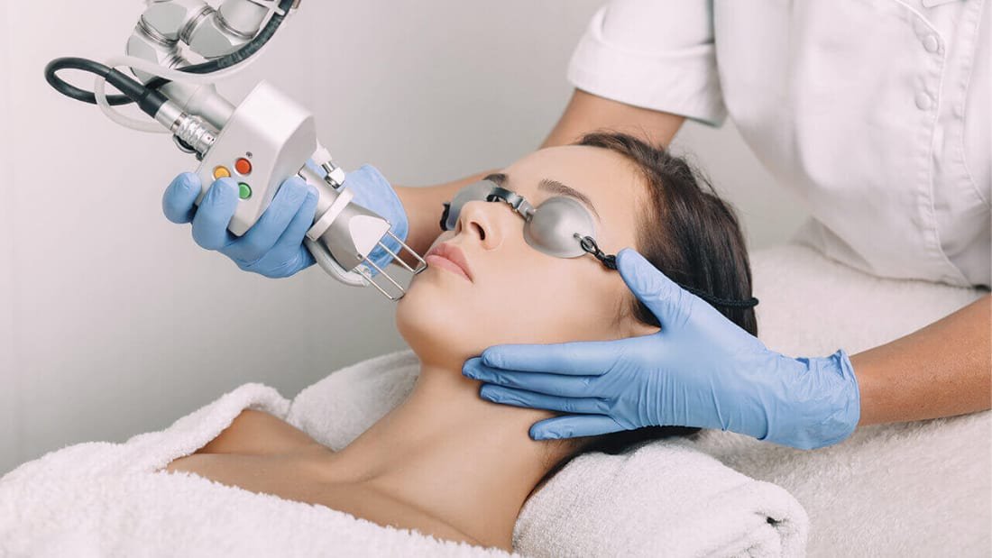 Aplicación de láser CO₂ fraccionado en tratamiento estético facial