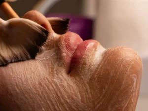 Tratamiento exfoliación facial primavera BCNClinic Barcelona preparando piel renovada luminosa después invierno con peeling profesional