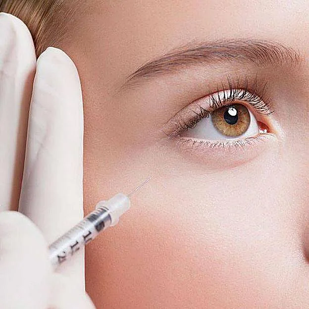 Tratamiento relleno ojeras ácido hialurónico BCNClinic Barcelona mostrando técnica profesional para eliminar ojeras oscuras y mirada cansada